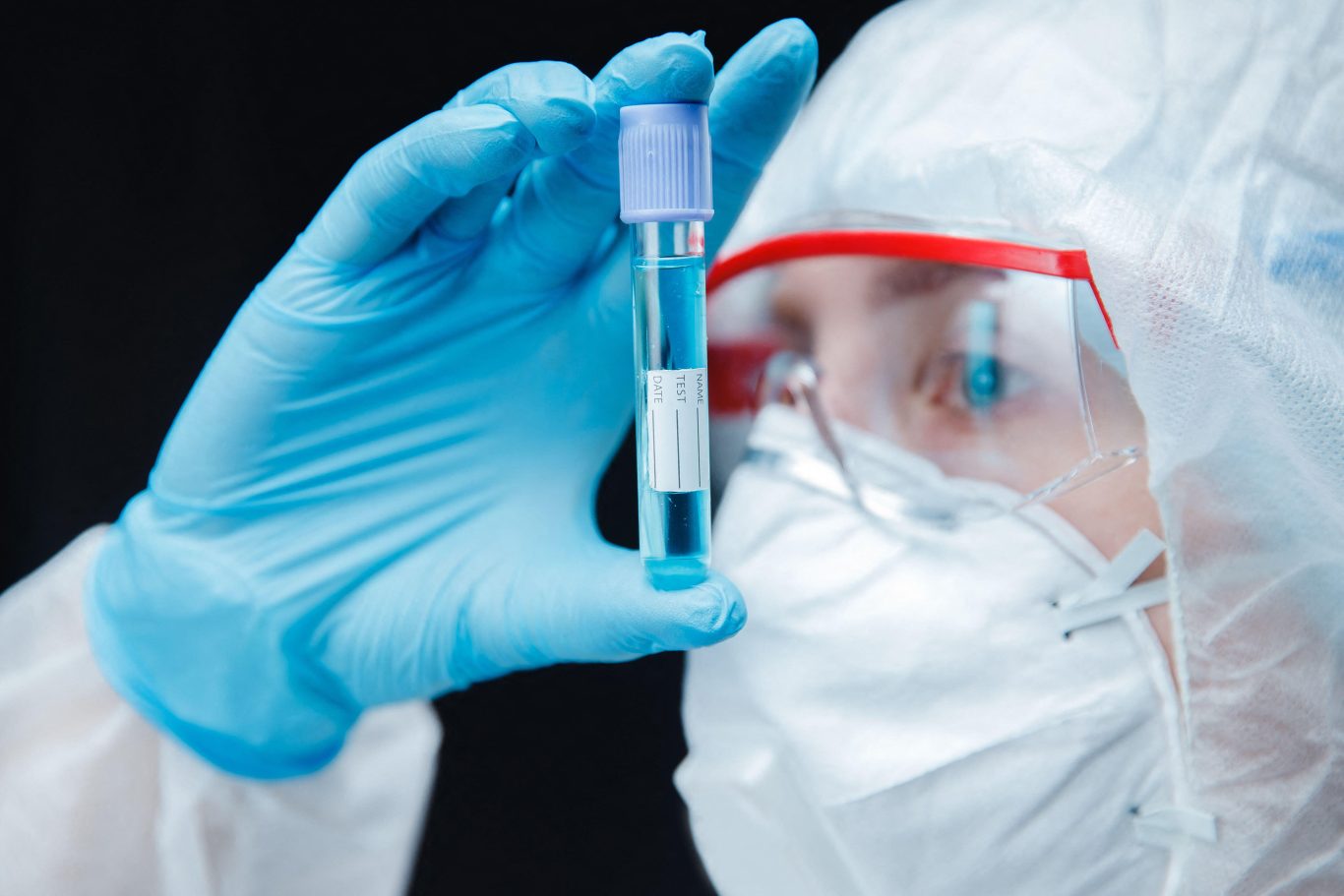 Russian Plague Laboratory Death Raises Alarming Questions About Biological Threats — Could the Black Death Return?